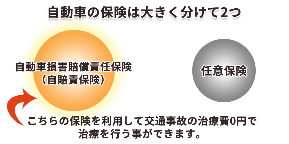 自動車保険の違い