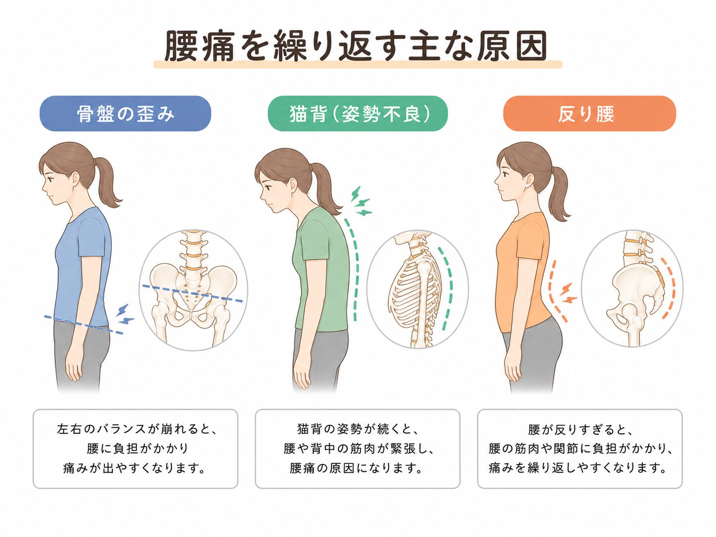骨盤バランスと腰痛の関係|草津市